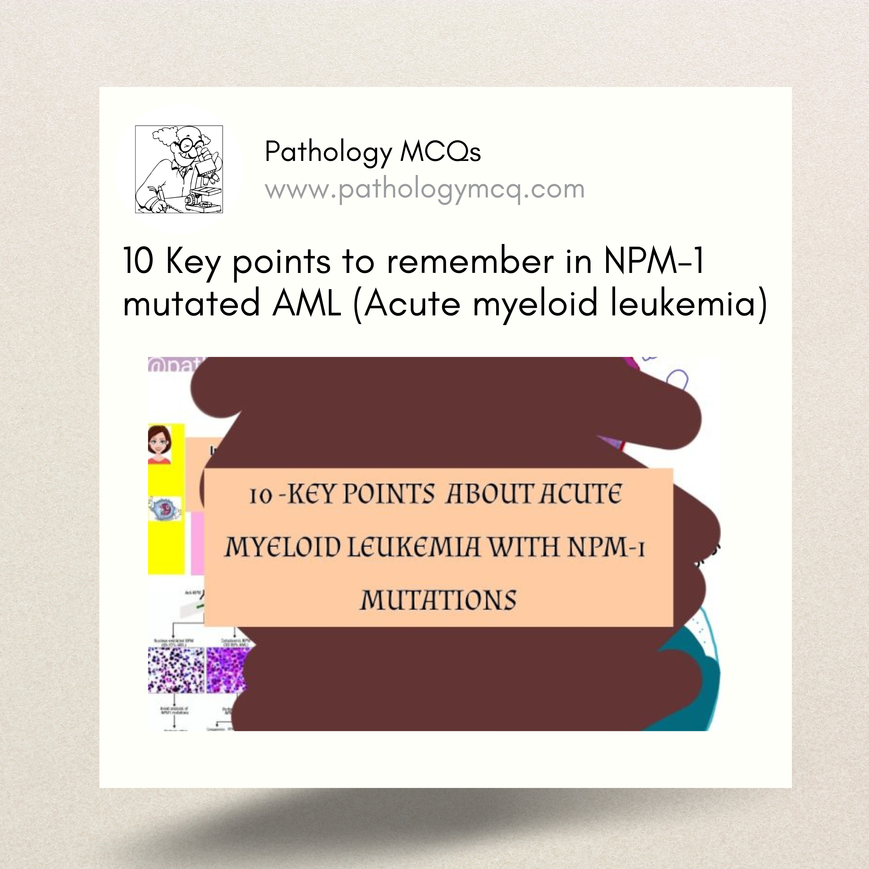10 Key points to remember in NPM-1 mutated AML (Acute myeloid leukemia)