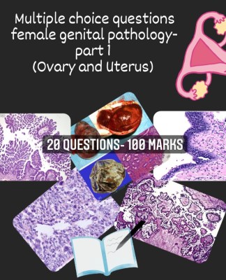 Female genital tract pathology: Useful for Pathology residents preparing for, NEET-SS/ DM- Oncopathology/ DM Histopathology, Fellowships, FRCPath- Histopathology, American Board of anatomic and clinical pathology