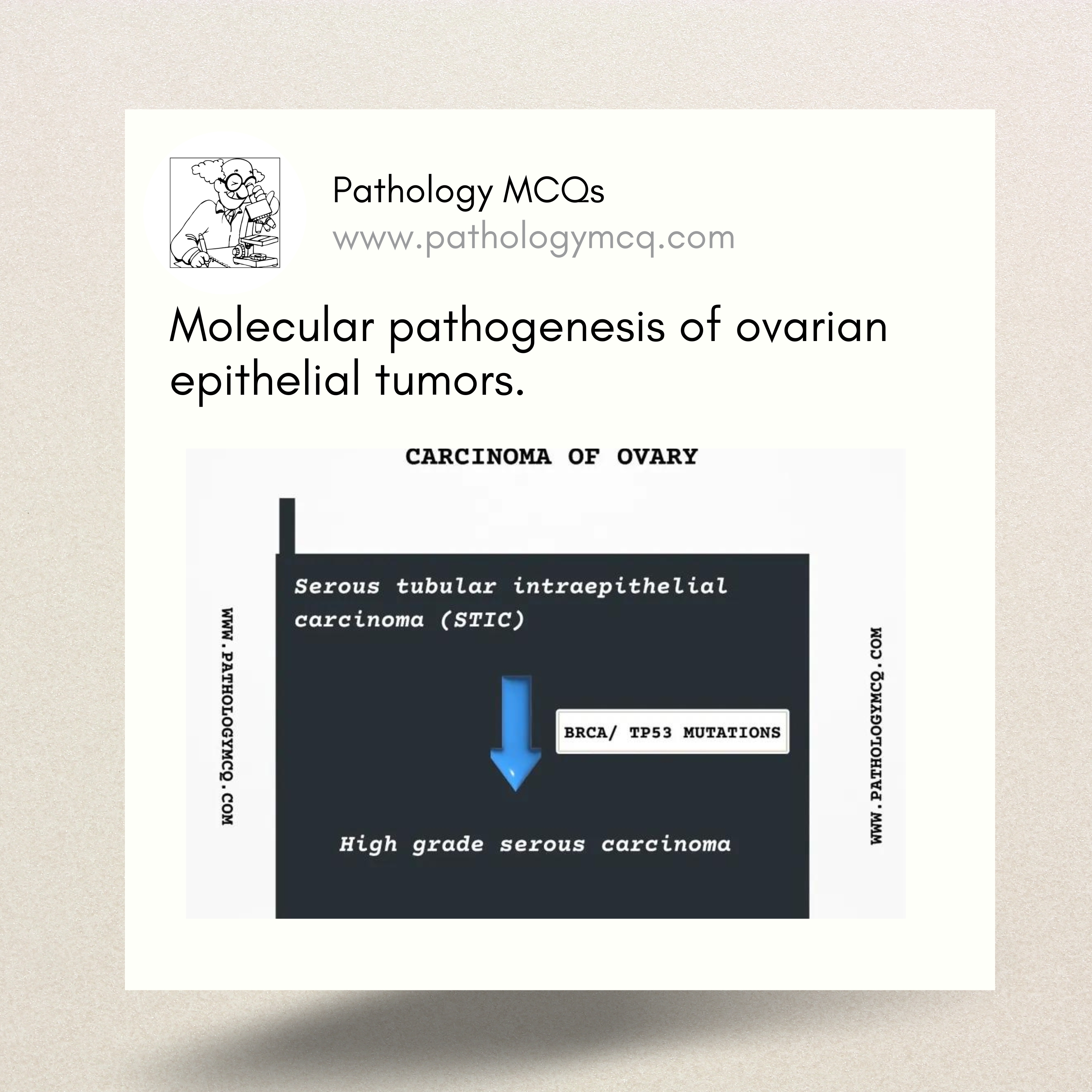 Molecular pathogenesis of ovarian epithelial tumors.