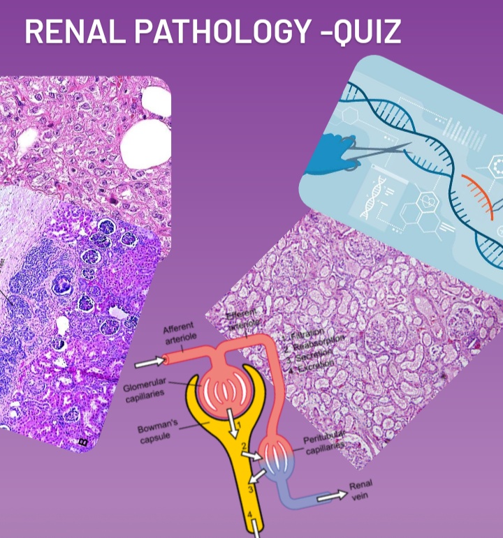 Renal pathology quiz for NEET-SS/ DM- Oncopathology/ DM Histopathology, Fellowships, FRCPath- Histopathology and AP/CP boards