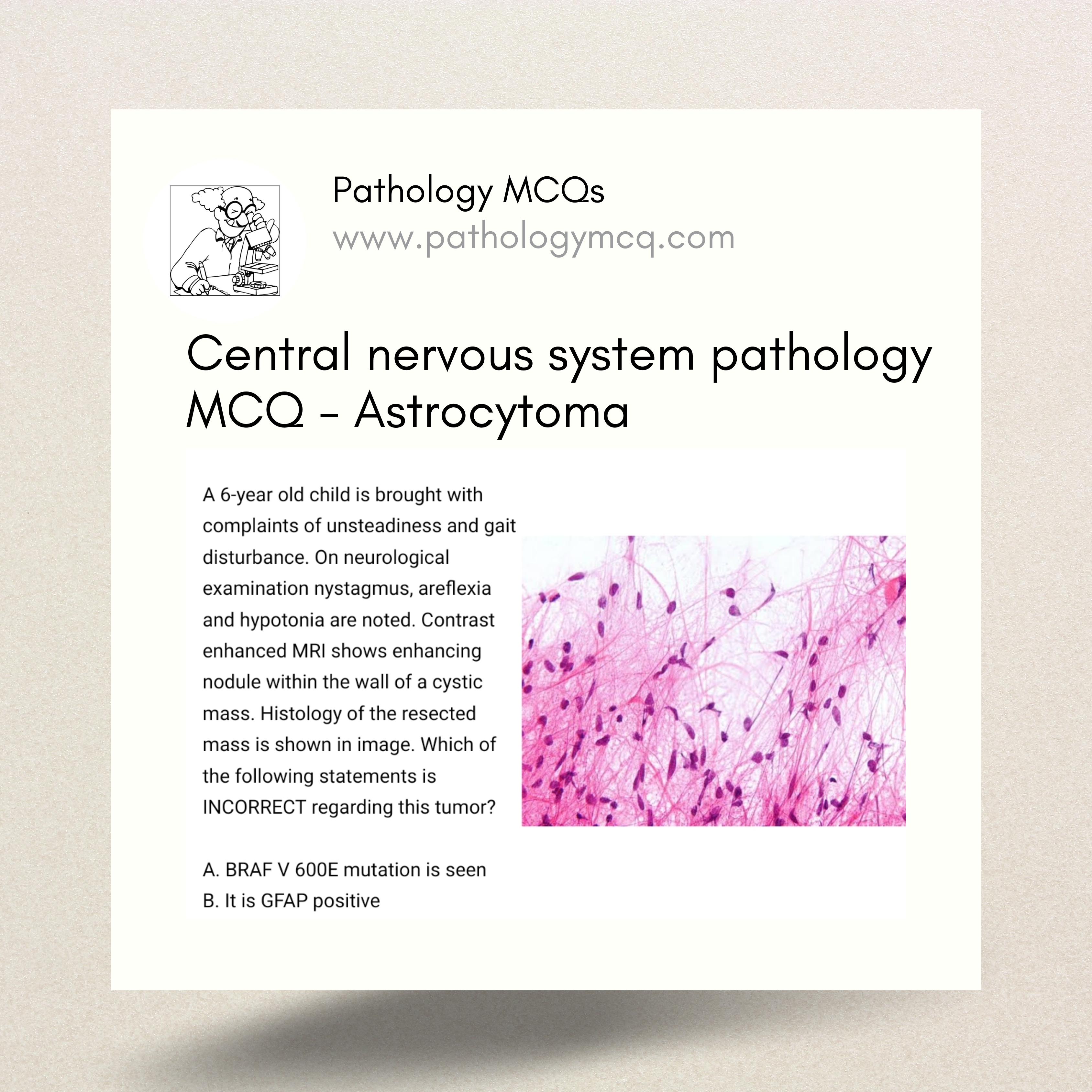 Central nervous system pathology MCQ – Astrocytoma