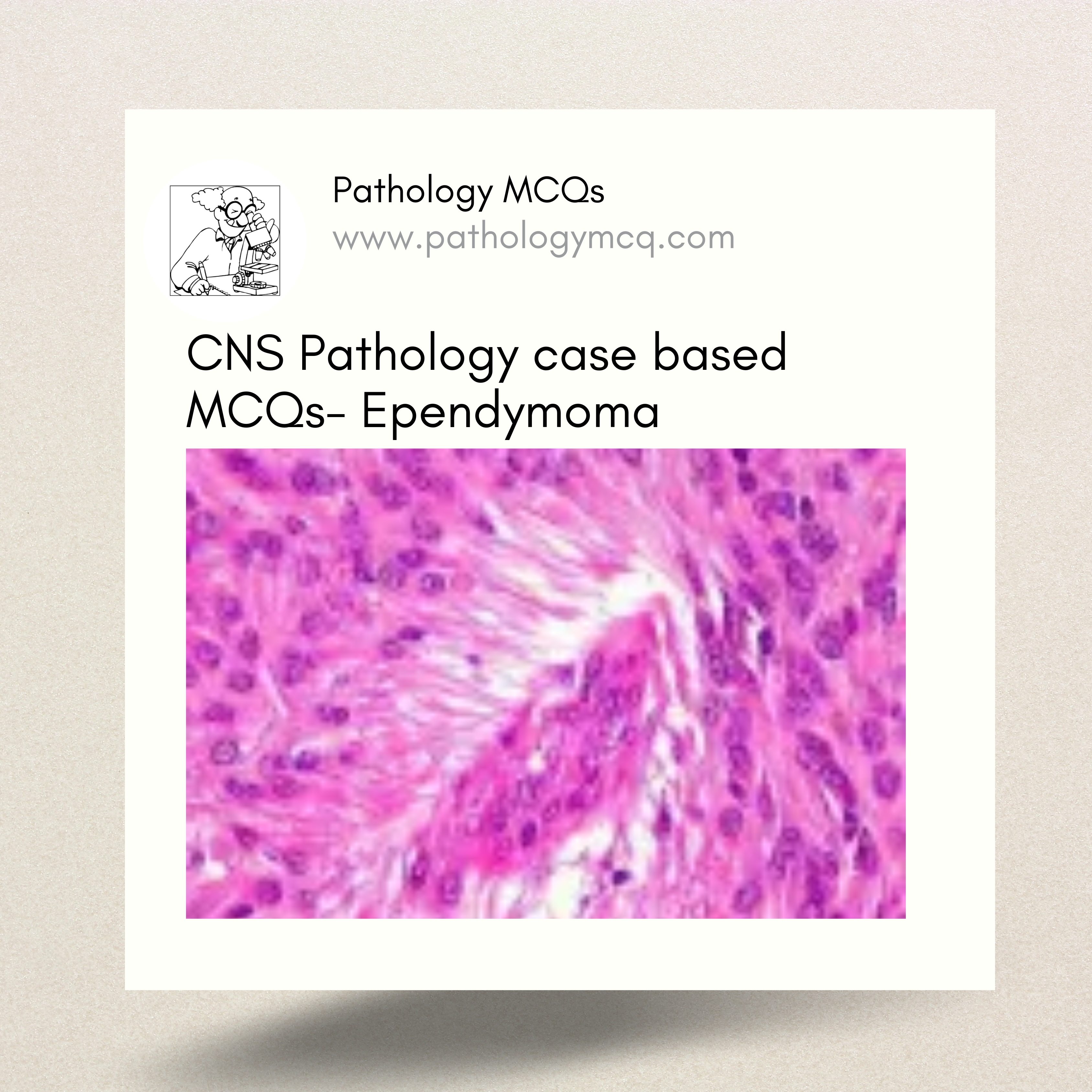 CNS Pathology case based MCQs-Ependymoma
