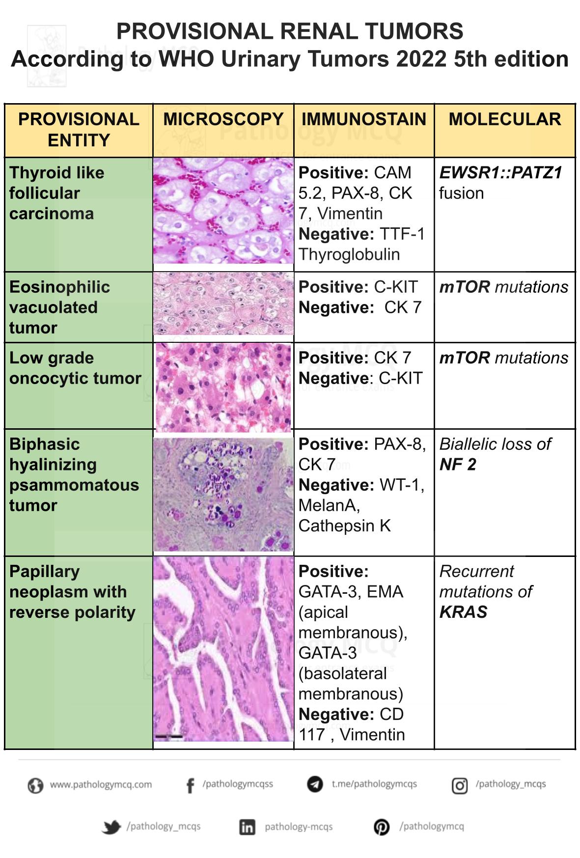 Summary of provisional renal tumors-according to WHO 2022 urinary tumors 5th edition