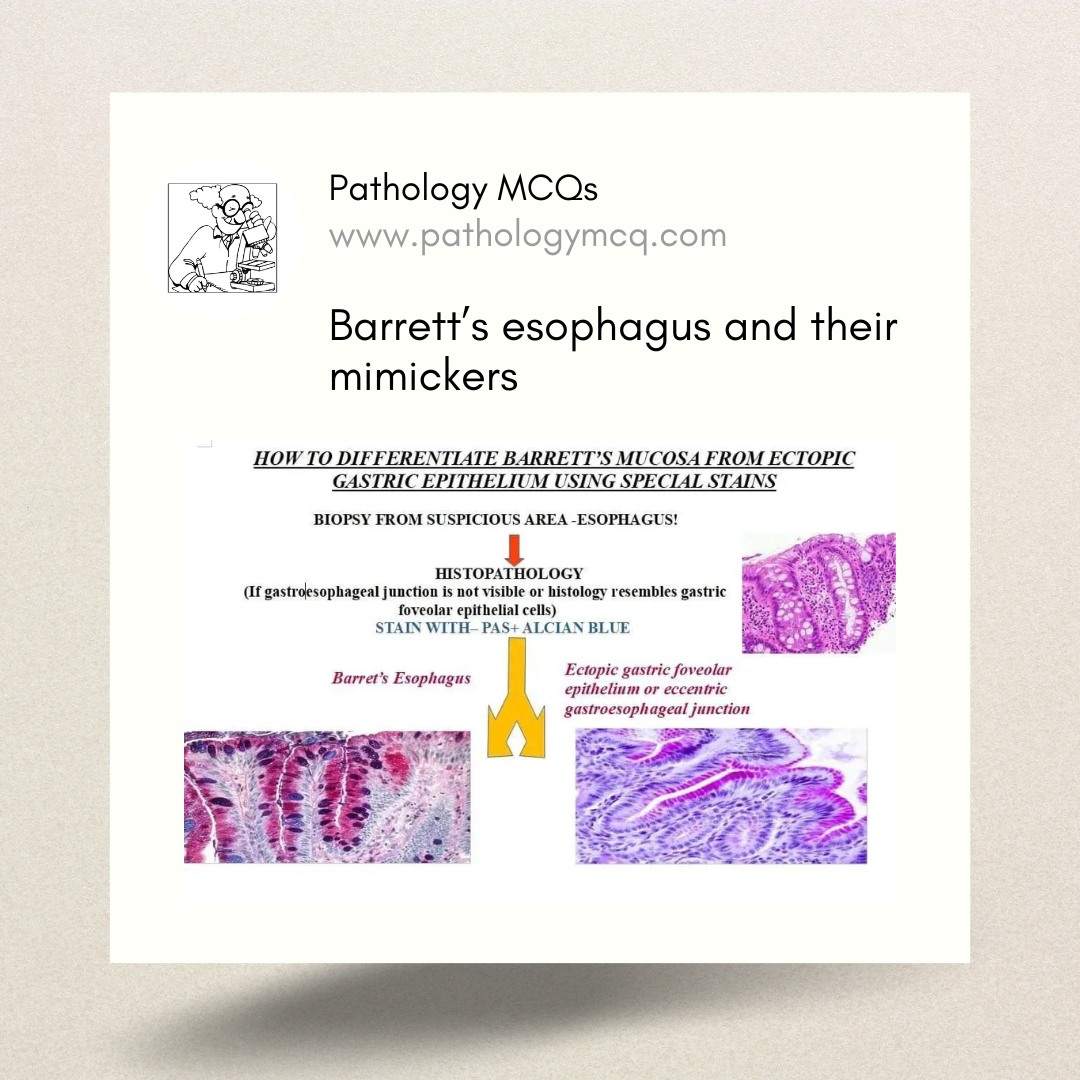 Barrett’s Esophagus and their mimickers
