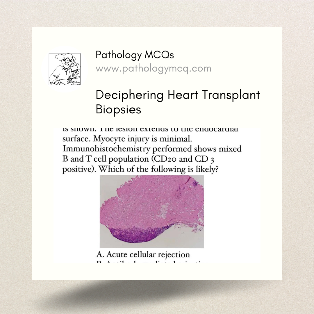 Deciphering Heart Transplant Biopsies: ACR, AMR, and Quilty Lesions Explained