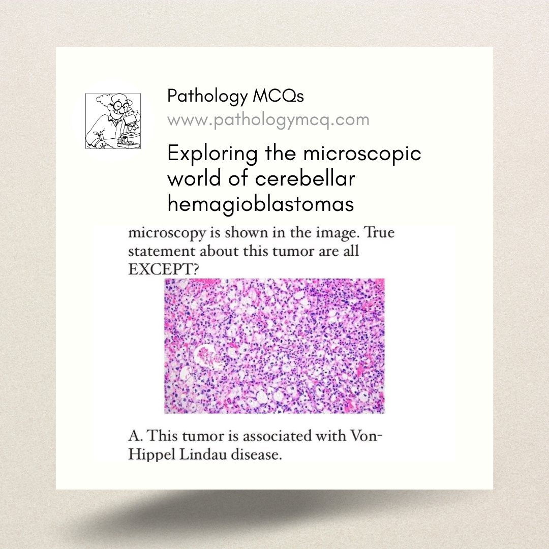 Exploring the Microscopic World of Cerebellar Hemangioblastoma