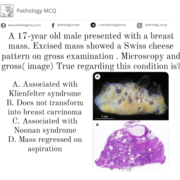 Pathology MCQs for various entrance exams