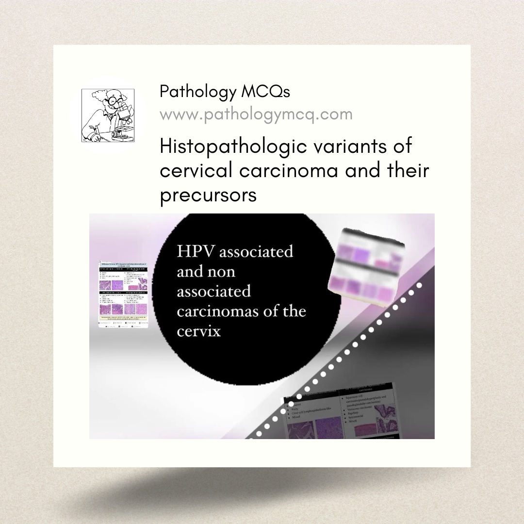 Understanding the Histopathologic Variants of Cervical Carcinomas and precursor lesions: The Role of HPV