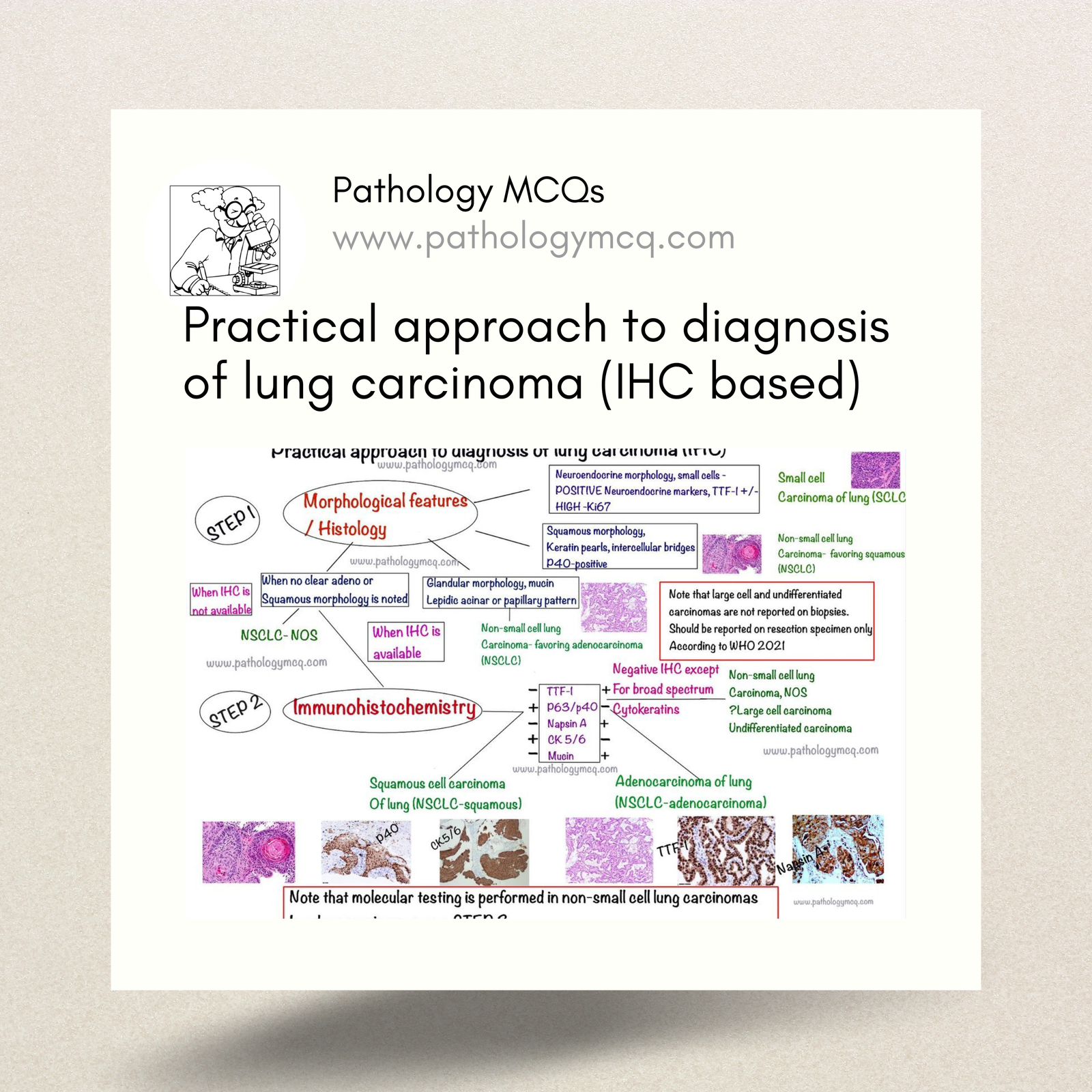 Stepwise Algorithmic Approach to IHC-Based Diagnosis of Lung Carcinoma: A Comprehensive Guide