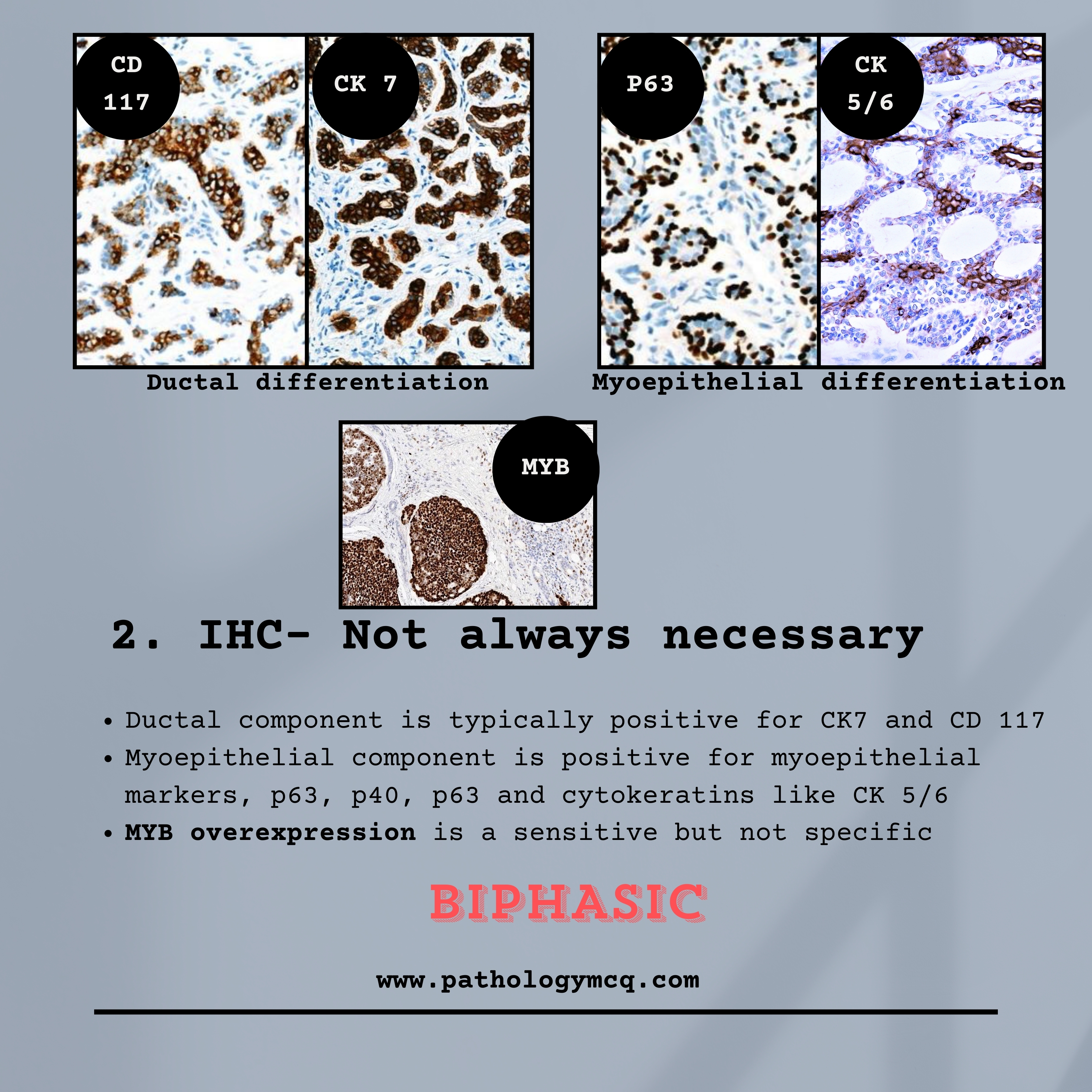 Key points in Adenoid cystic carcinoma (ACC) - PATHOLOGY MCQs