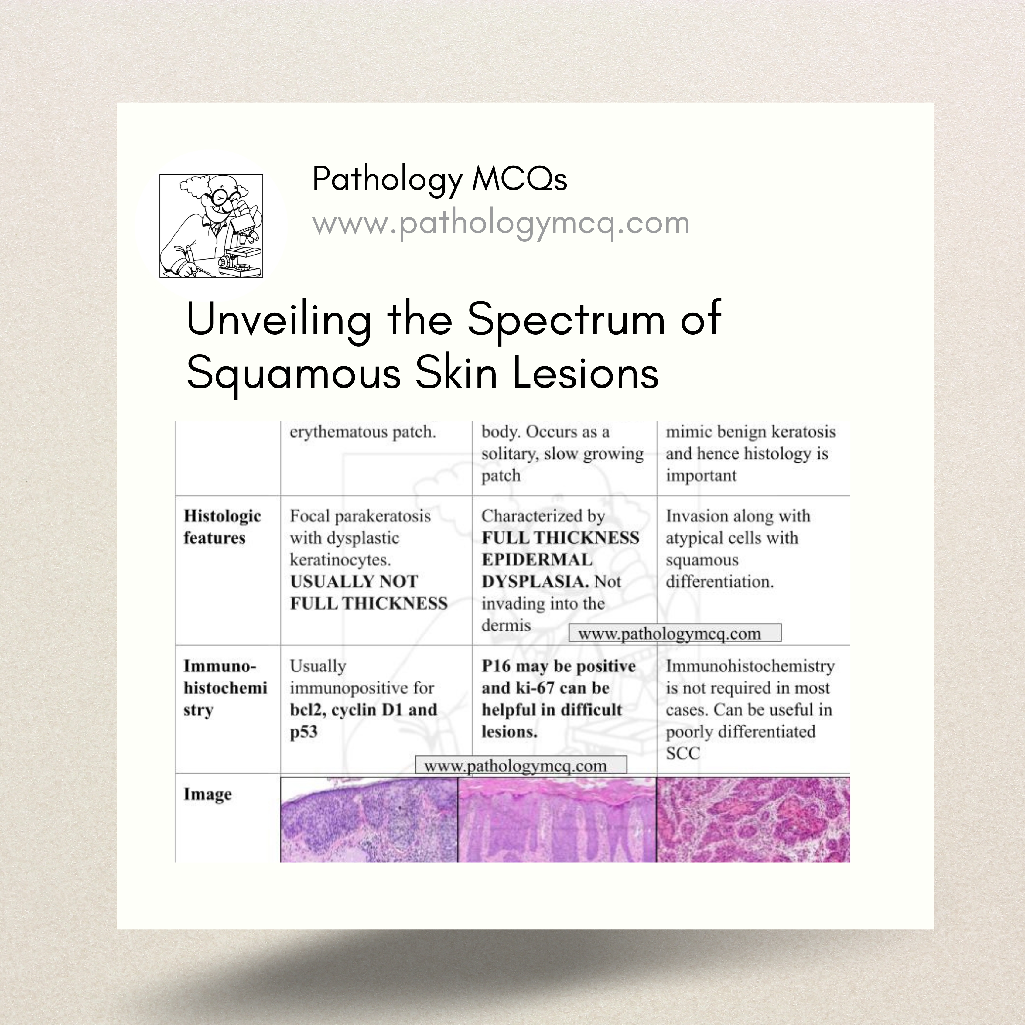 Actinic Keratosis, Bowen’s Disease, and Squamous Cell Carcinoma: A Histological Journey
