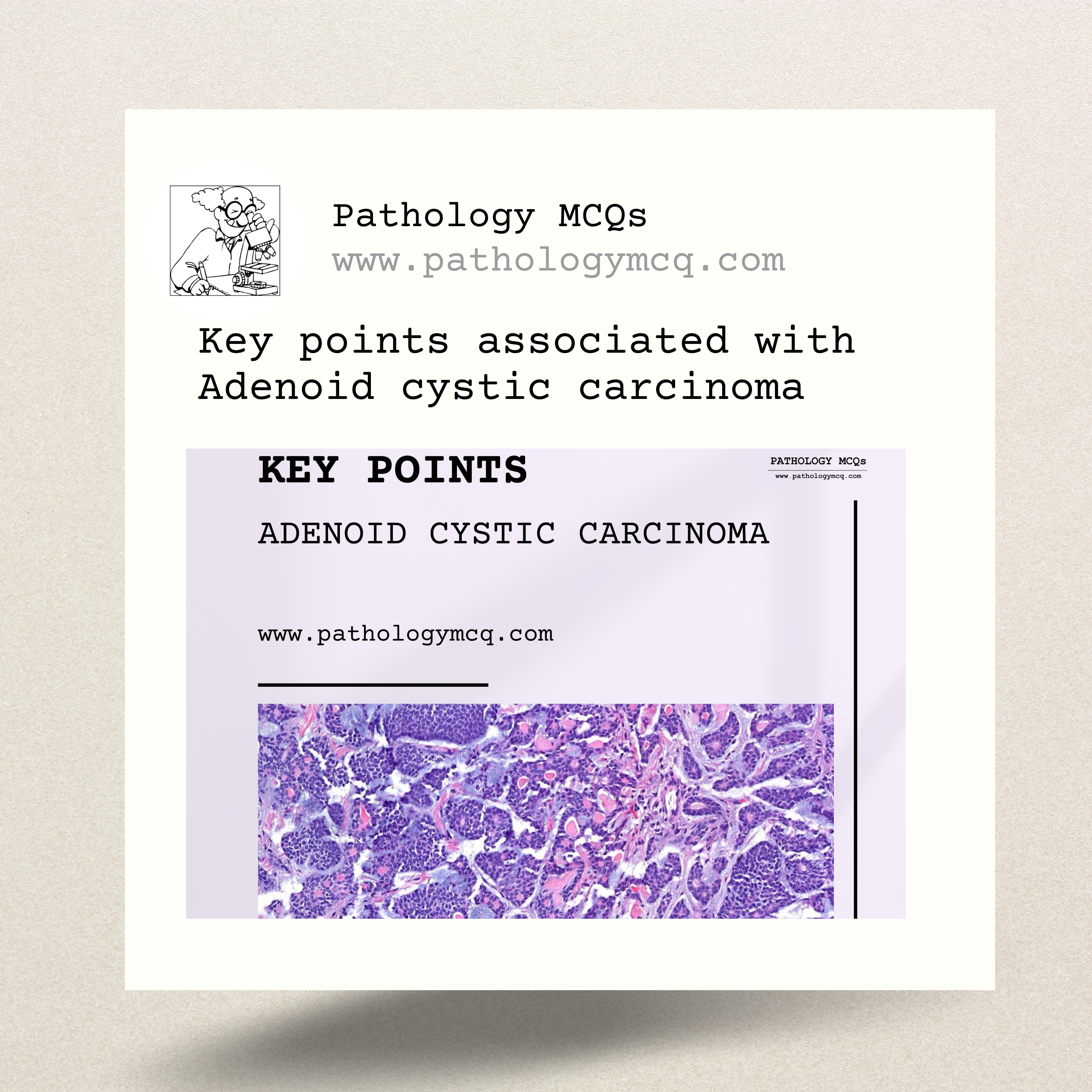 Key points in Adenoid cystic carcinoma (ACC)
