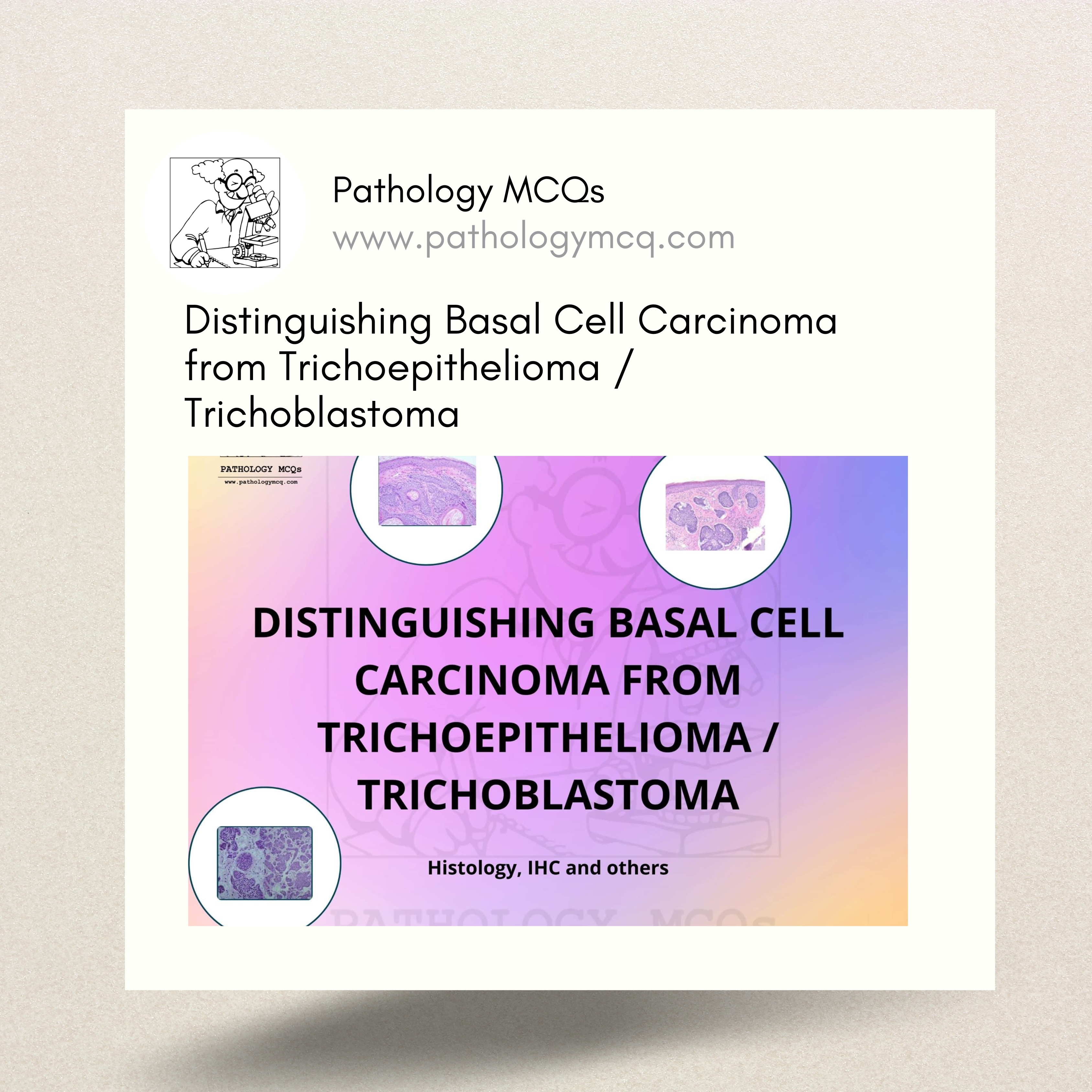 Distinguishing Basal Cell Carcinoma from Trichoepithelioma ...