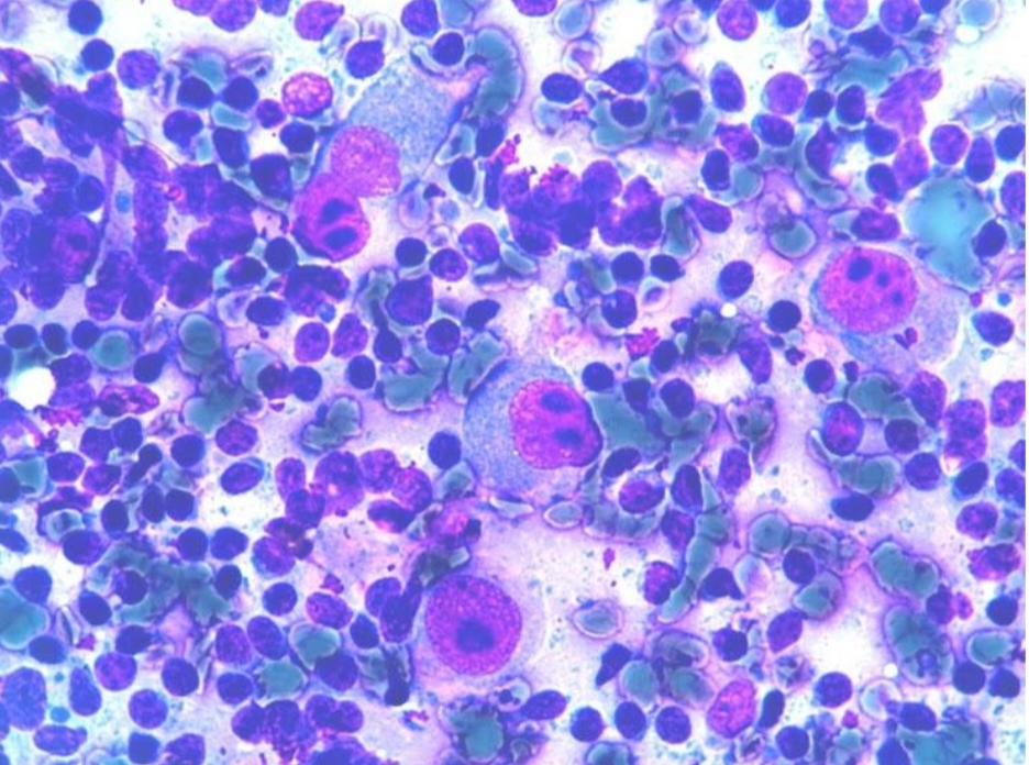 Pathology Mcqs For Various Entrance Exams