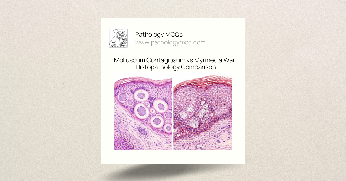 Molluscum Contagiosum vs Myrmecia Wart Histopathology | Diagnostic Clues & MCQs