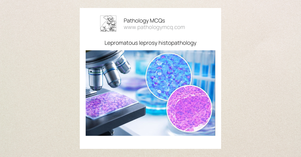 Lepromatous Leprosy โ Histopathology, Diagnosis & MCQs