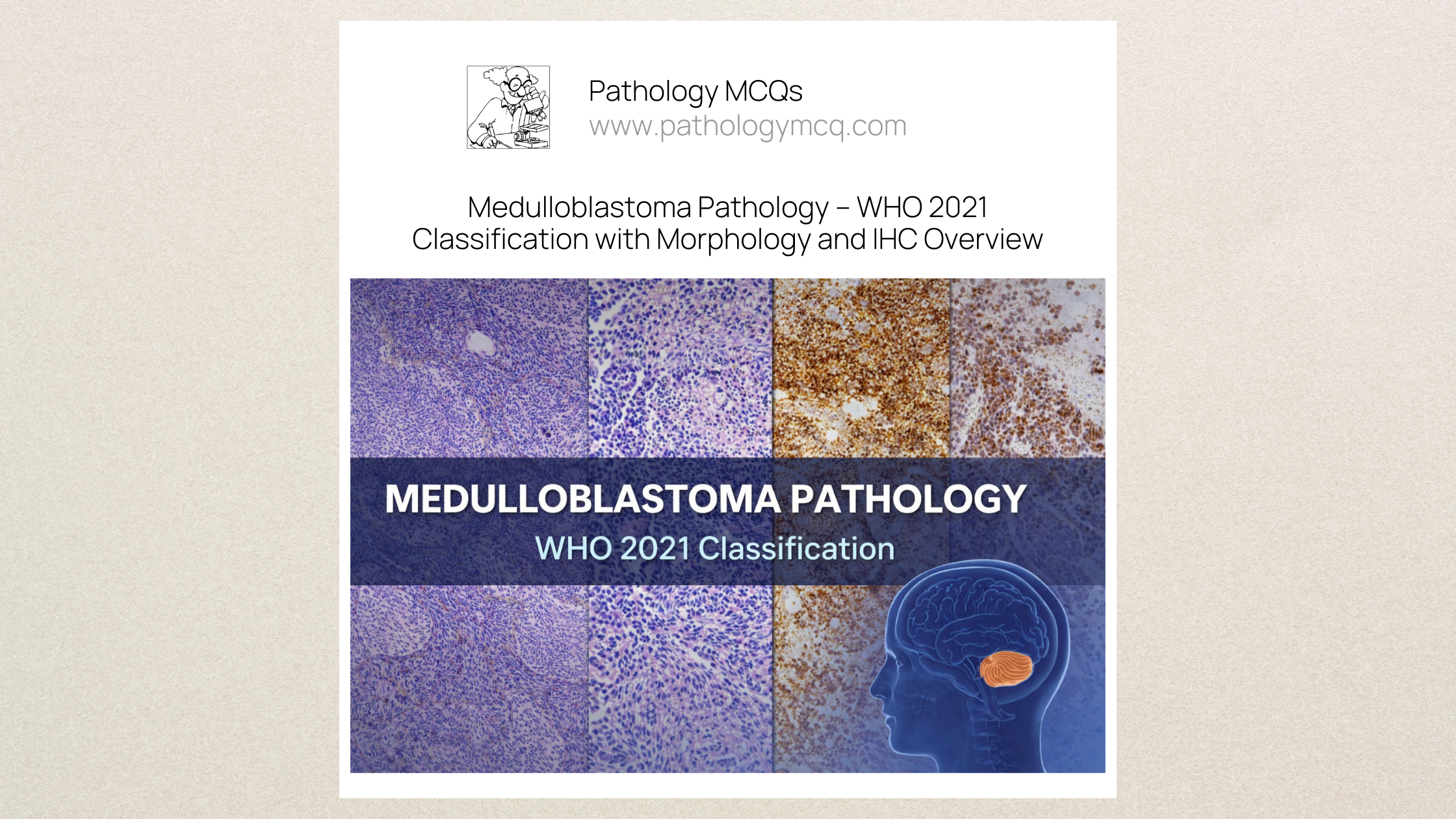 Medulloblastoma Pathology โ Morphology, Immunohistochemistry and WHO 2021 Classification