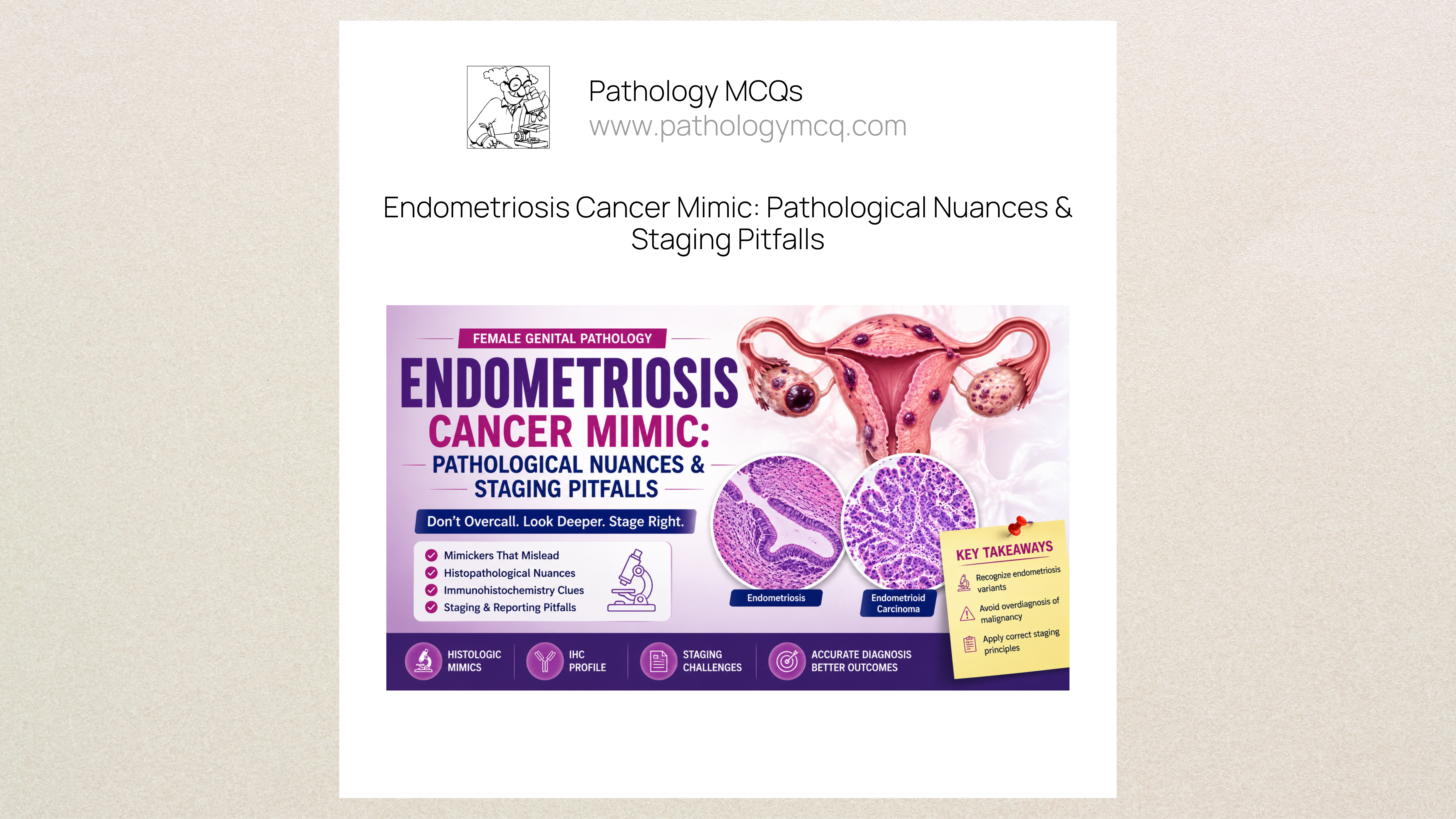 Endometriosis Cancer Mimic: Pathological Nuances & Staging Pitfalls