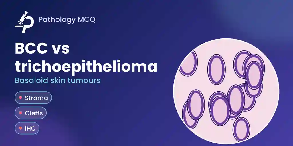 Basal Cell Carcinoma vs Trichoepithelioma/Trichoblastoma: Histology, Stroma, IHC Panel, Virtual Slides and MCQs