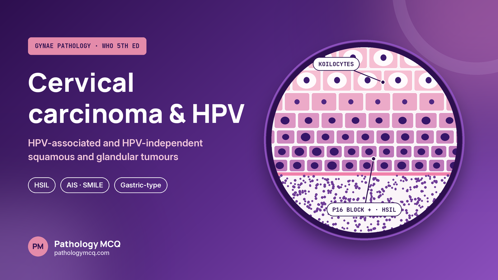 Cervical Carcinoma and HPV: WHO 5th Edition HPV-Associated and HPV-Independent Tumours, Precursors, p16, Silva Patterns, Virtual Slides and MCQs