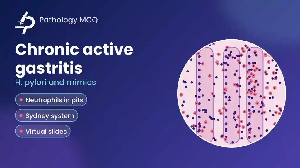 Chronic Active Gastritis: Histology, H. pylori, Sydney System, Mimics, Virtual Slides and MCQs