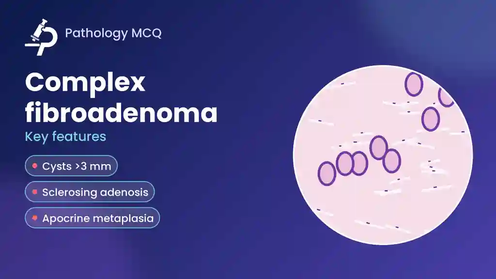 Complex Fibroadenoma of the Breast: WHO Criteria, Cancer Risk, Phyllodes Mimics and MCQs