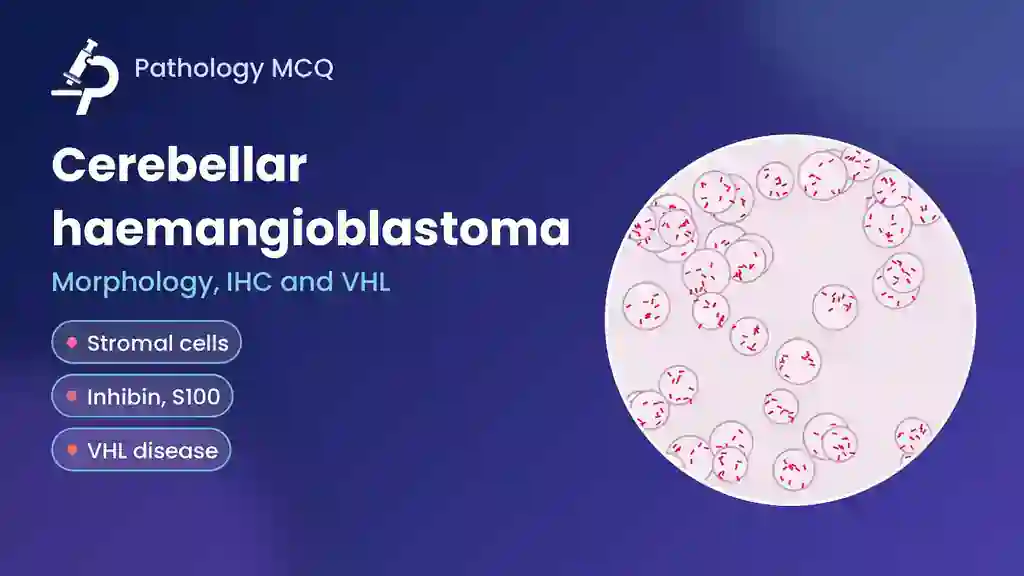 Cerebellar Haemangioblastoma: Histology, IHC vs Metastatic RCC, VHL and MCQs