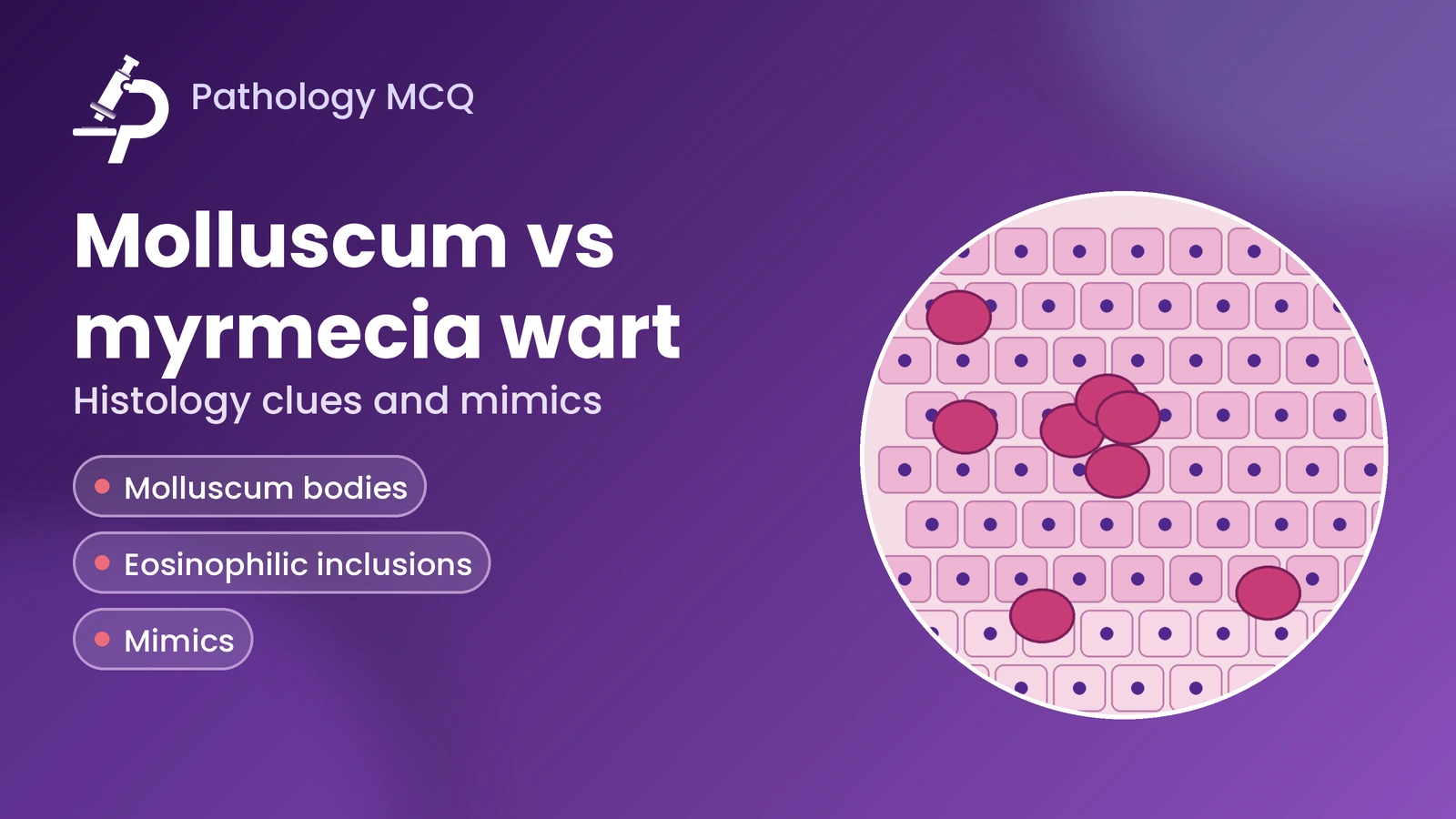 Molluscum Contagiosum vs Myrmecia Wart Histopathology | Diagnostic Clues & MCQs