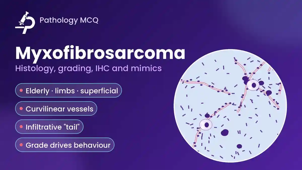 Myxofibrosarcoma: Histopathology, Grading, IHC and Differential Diagnosis