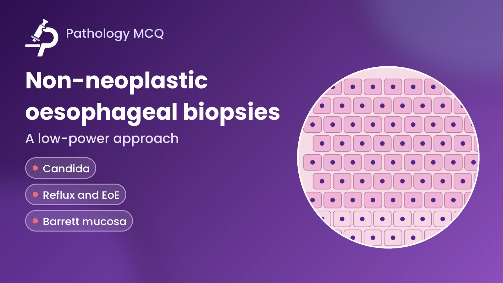 A Quick Guide to Non-Neoplastic Esophageal Biopsies