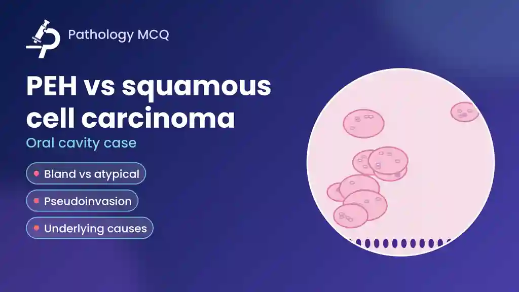 Case: 43-Year-Old Man With a 1 cm Oral Lesion – Pseudoepitheliomatous Hyperplasia vs Squamous Cell Carcinoma