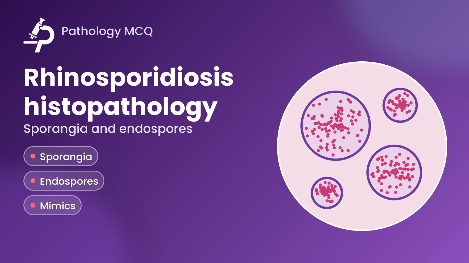Rhinosporidiosis Histopathology Case Study – Sporangial Life Cycle, Mimics, Virtual Slides and MCQs