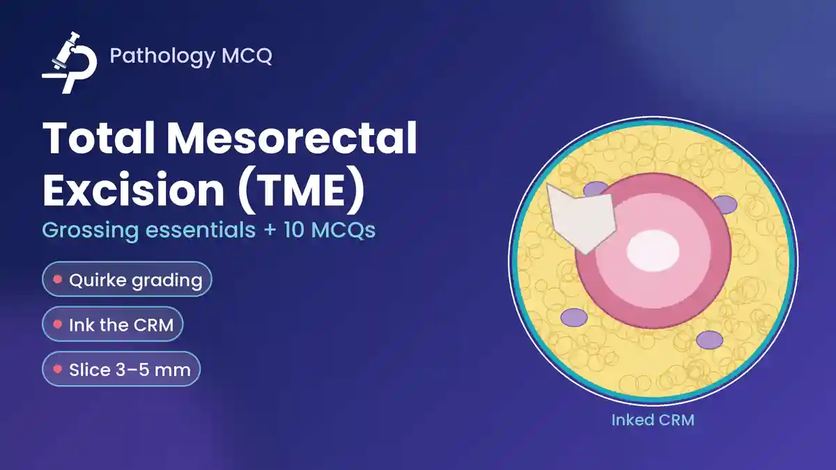 Total Mesorectal Excision (TME) Grossing: Mesorectal Grading, CRM and Block Selection, with MCQs
